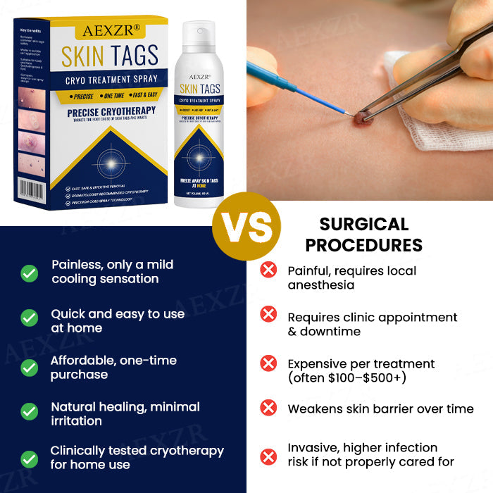 AEXZR® cryotherapy Spray: Quick removal of warts and corneas - results visible in 7 days ✨
