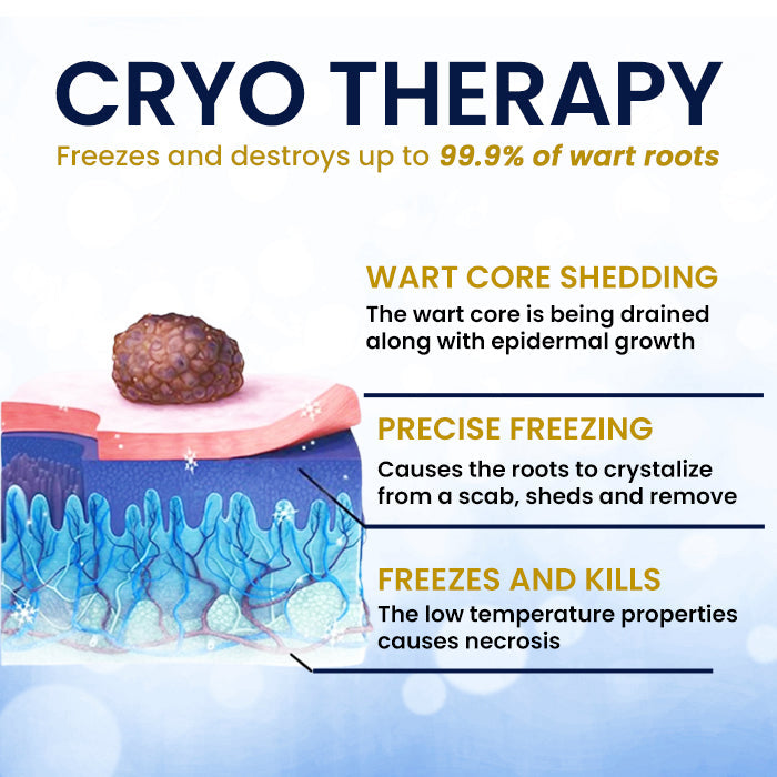 AEXZR® cryotherapy Spray: Quick removal of warts and corneas - results visible in 7 days ✨