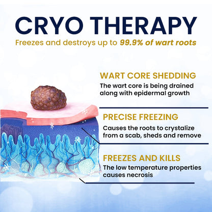 AEXZR® cryotherapy Spray: Quick removal of warts and corneas - results visible in 7 days ✨