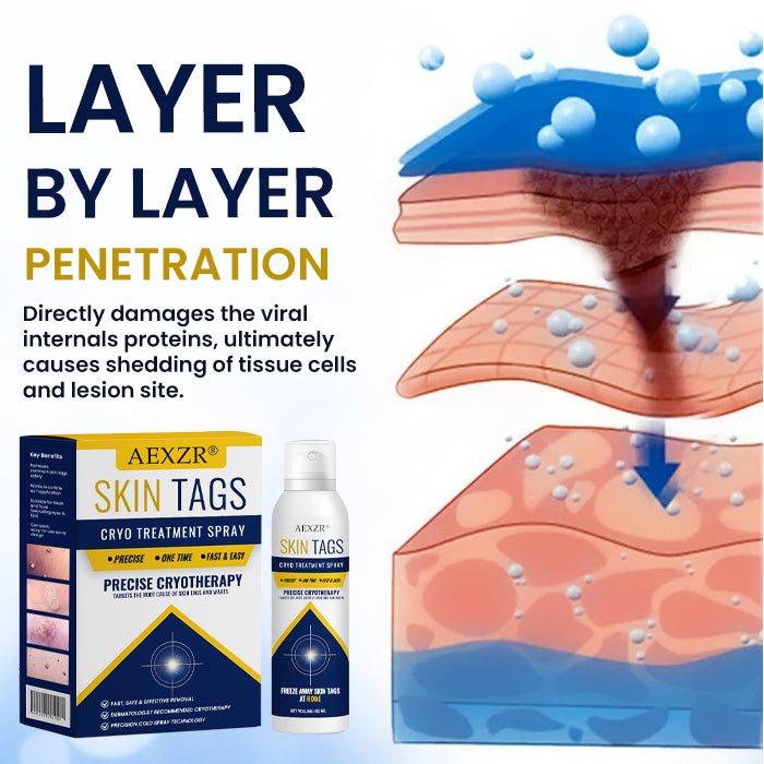 AEXZR® cryotherapy Spray: Quick removal of warts and corneas - results visible in 7 days ✨