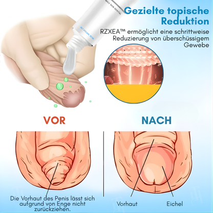 Nur für kurze Zeit! ⚡ RZXEA™ Vorhaut-Elastizitätsgel: Holen Sie sich Ihren Vorsprung zurück, starten Sie Ihre Vitalität neu.