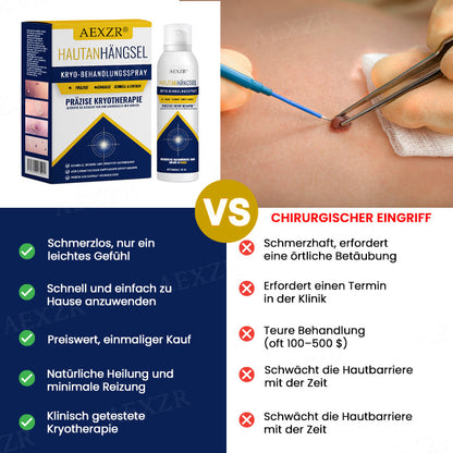 AEXZR® Hautanhängsel-Kryo-Behandlungsspray