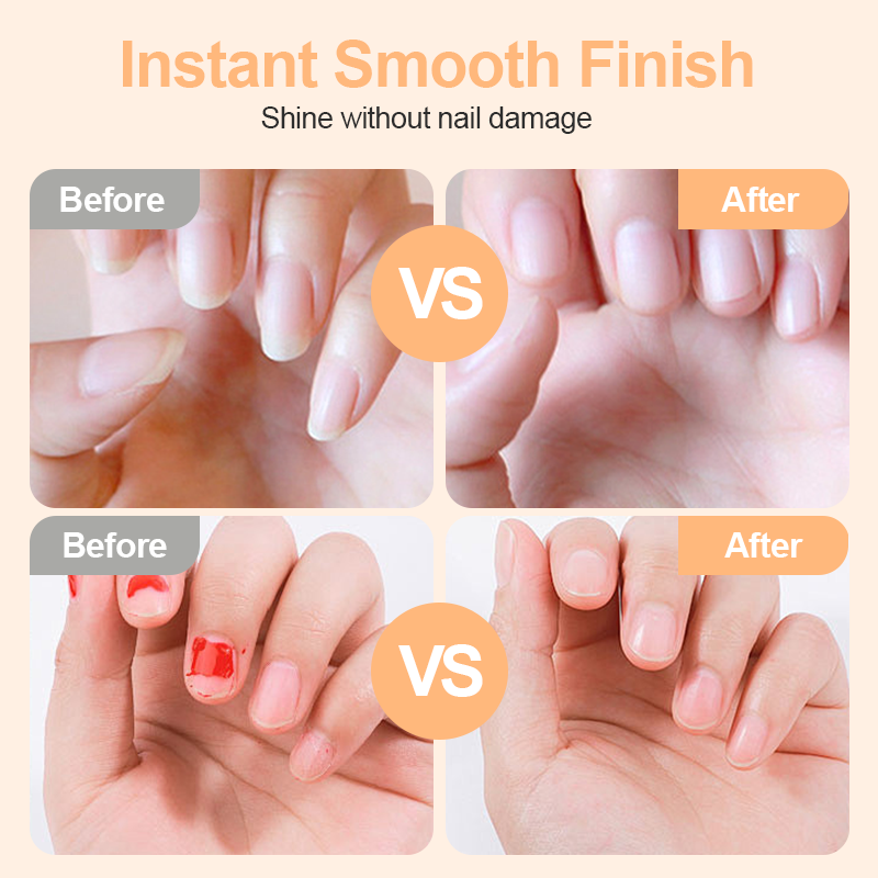 💗LAST DAY SALE 49% OFF⚡50K+ SOLD💕🌟AEXZR® 2-in-1 Safe Electric Nail Clipper
