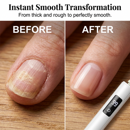 Limited Stock!!! AEXZR®🥳2026 HOT SALE🥳💞50K+ SOLD!💅✨ 50% OFF! Professional Electric Nail Polisher – Smooths thick nails, 99-speed display. Multiple heads for shaping & buffing. Salon at home! 🌟💎